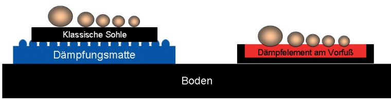 Vergleich der Mechanik von Matte und Vorfußdämpfung. Die Mittelfußköpfchen...